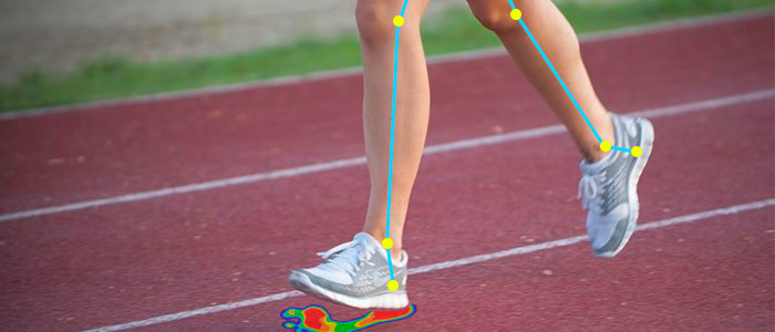 Lesiones tendinosas
